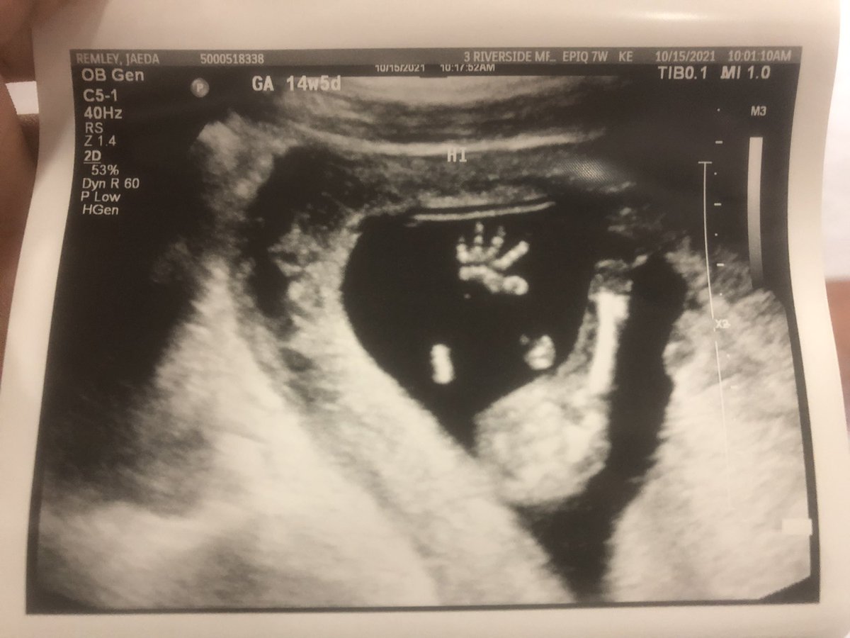 jaedajaeee's tweet photo. Even tho I’m having another lil baby you’ll forever be my baby boy 🥰💙 https://t.co/jAMC2RLTWM