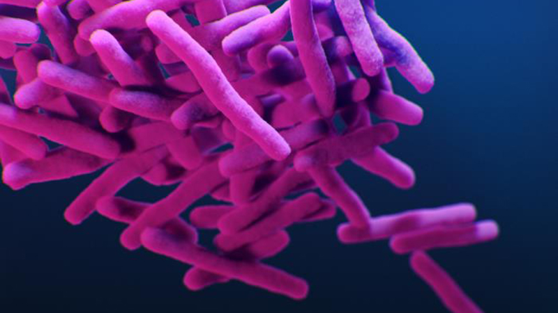 CDC_AMD's tweet photo. #AMDClips: Understanding #TB chains is key to preventing transmission. Learn how the @CDC_AMD supported Logically Inferred Tuberculosis Transmission algorithm is used to systematize integration and analysis of #WGS, clinical, and epidemiological data. https://t.co/rASv2NzXO2 https://t.co/djfTkLx4EA