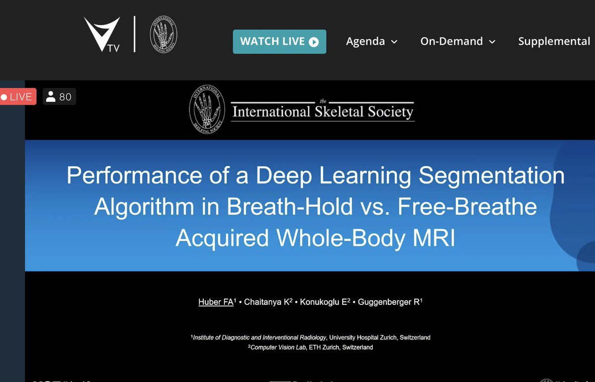 Juerg Hodler (@jhodler) on Twitter photo USZ radiology resident Florian Huber at the virtual meeting of the International Skeletal Society, on Whole body MR imaging: Free breathing acquisition allows for scan time reduction when compared to breathhold imaging.
#iss2021
<a href="/Unispital_USZ/">Unispital_USZ</a>
<a href="/RadiologieUSZ/">Radiologie USZ</a>
<a href="/intskeletal/">International Skeletal Society | ISS</a> USZ radiology resident Florian Huber at the virtual meeting of the International Skeletal Society, on Whole body MR imaging: Free breathing acquisition allows for scan time reduction when compared to breathhold imaging.
#iss2021
<a href="/Unispital_USZ/">Unispital_USZ</a>
<a href="/RadiologieUSZ/">Radiologie USZ</a>
<a href="/intskeletal/">International Skeletal Society | ISS</a>