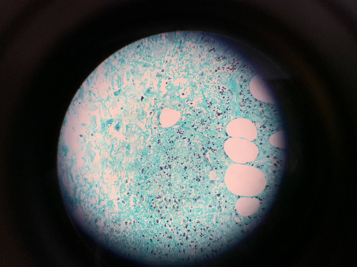 SStepenaskie's tweet photo. @cebulka26 It was hard to get image centered with a steady hand.  Once it was centered I tapped the screen which made it fill my screen.  Good luck! https://t.co/vPEM3ujH5a