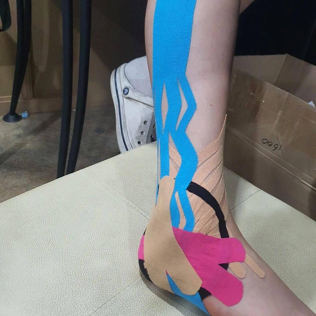 KinesioTape's tweet photo. #Repost @ryusangkyun_
I couldn't even walk, but this is possible
#anklesprain #removeswelling #PainRelief #kinesiotaping #lymphatictaping #jellyfishtaping #x-cut #basketweave
#kinesiouniversity #CKTT #CKTP
#CKTP+ #Ph.D_Ryu #ispykinesiotape
#kinesio #tapewithwisdom https://t.co/Dbw86PjfgA
