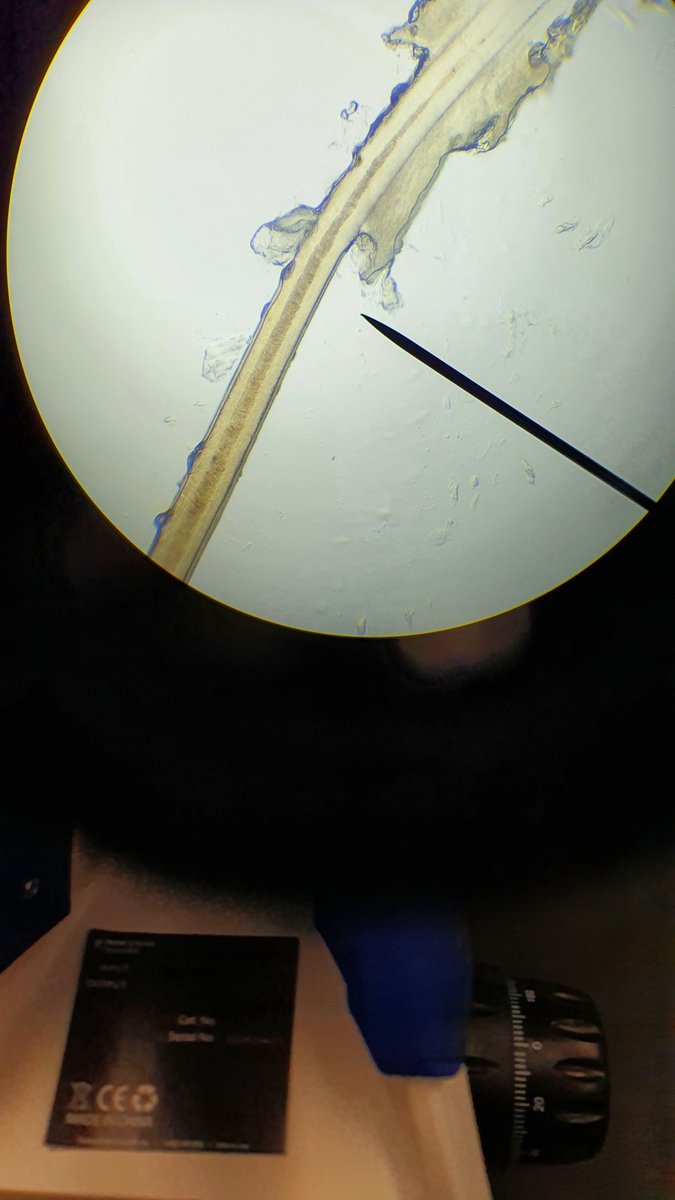beglisapayev's tweet photo. #PLTW #ABQ_SE
Hair Sample Observation. https://t.co/BqbagDj89F