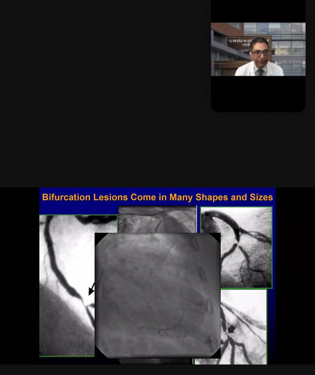 Happy to be in an IC fellowship that welcomes intercollegiate sharing of knowledge to mould us into experts in our field. This week's renown guest speaker, Dr Ramesh Daggubati, led a fantastic talk on bifurcation stenting. Thank you for teaching us so much. #UABStructural #UABIC