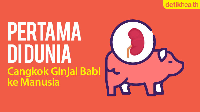 detikHealth's tweet photo. Bikin gempar dunia!!

Untuk pertama kalinya, ginjal babi ditransplantasikan ke manusia tanpa memicu reaksi penolakan oleh sistem imun tubuh. Diyakini sebagai terobosan penting untuk mengatasi kelangkaan donor organ.

#THREAD https://t.co/rXJT58xMBF