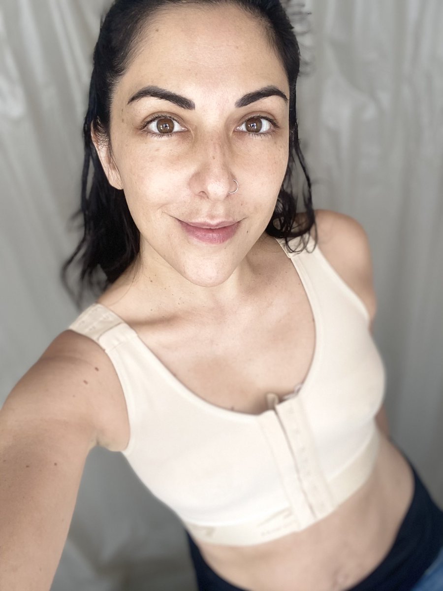 SandraCorcuera's tweet photo. Hoy cumple una semana de mi cirugía. ❤️
Llevaba 2 años dándole vueltas, ya me sentía incómoda hace tiempo, tenía molestias y últimamente se acentuaron los dolores... ⤵️
https://t.co/CpVmp3bvvu
#bii #breastimplantillness #explante https://t.co/pcVhwRUqlS