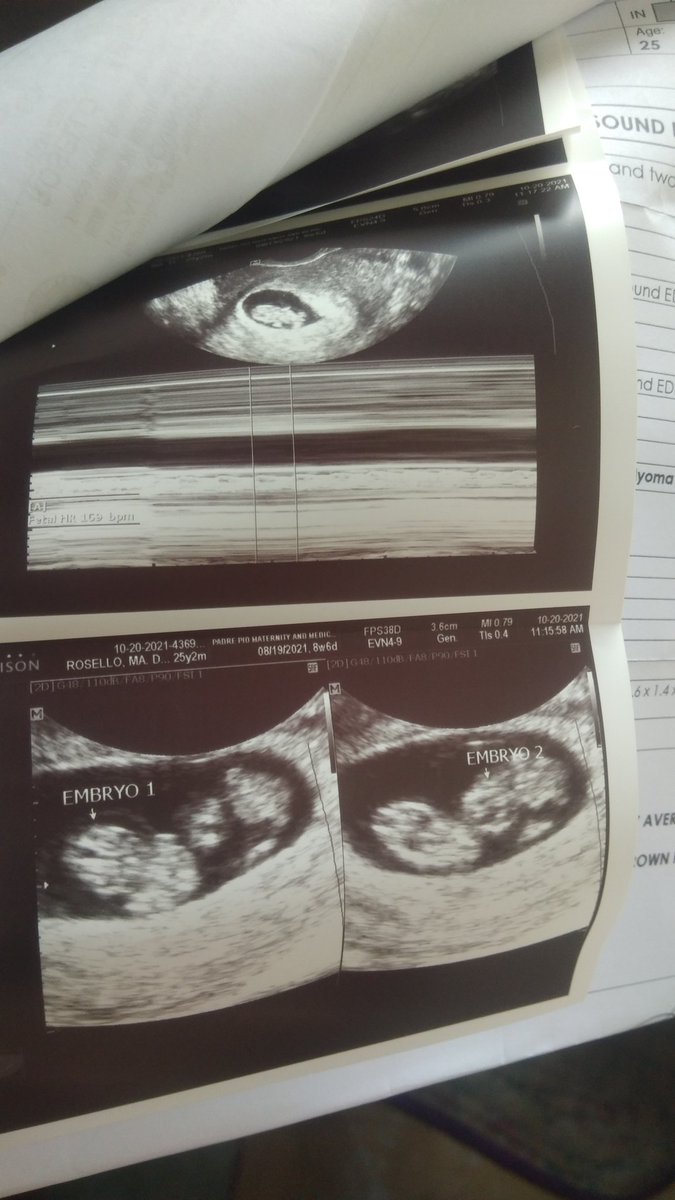 albertcaballes's tweet photo. Not one but twice😍👶👶 https://t.co/ekOwTY16fq
