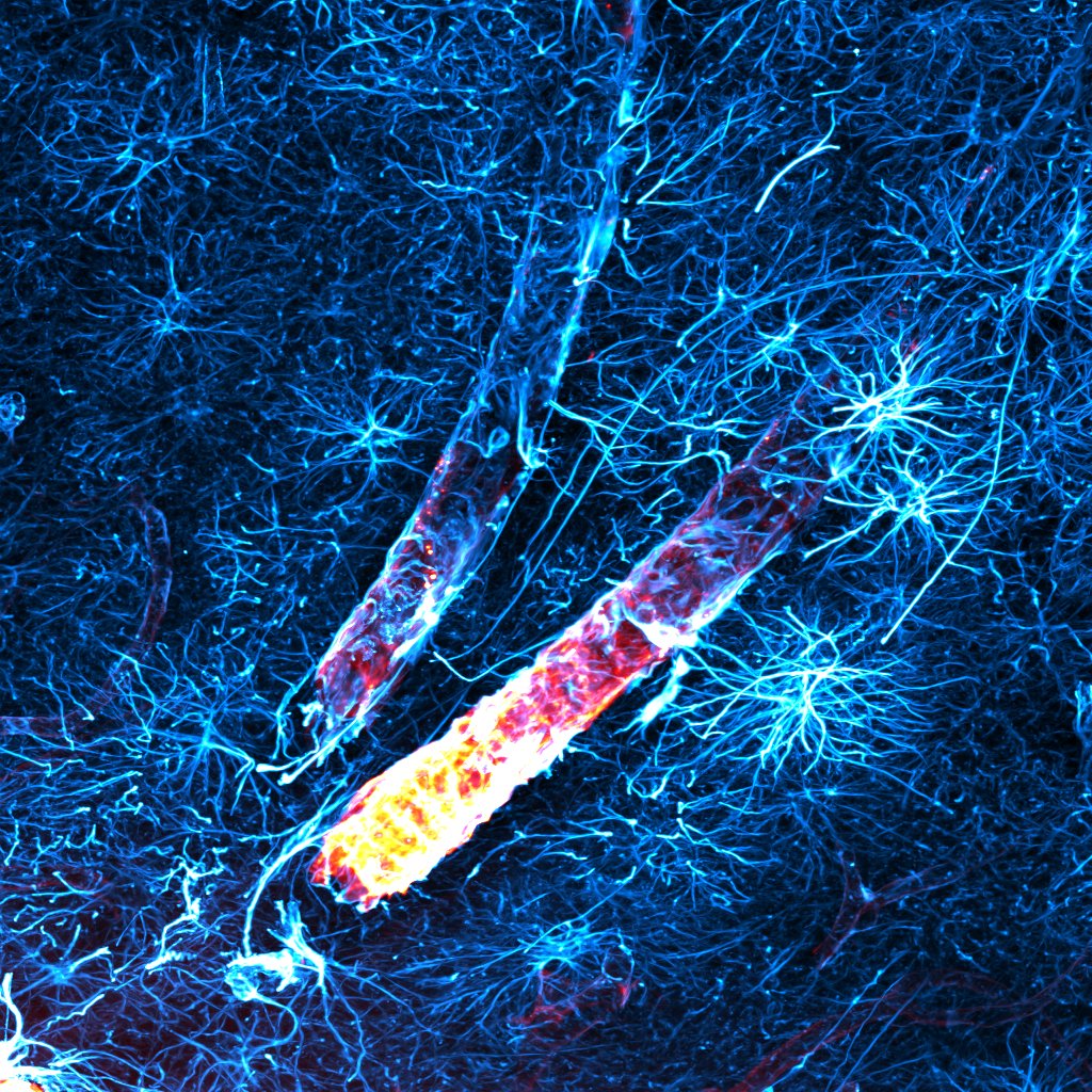 A brain of ice and fire ❄️🔥

#astrocytes #sciart #art #FluorescenceFriday #glymphatics