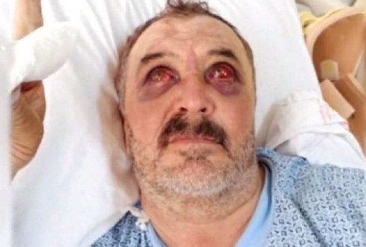 Ben Servet Turgut. Eylül ayı 2020 yılında Van Çatak'ta gözaltına alınarak, helikopterden atıldım. 21gün sonra yaşamımı yitirdim. Sorumlular değil gerçeği yazarak hukuksuzluğa tepki gösteren gazeteciler tutuklandı. Kürt kimliğim sebebiyle zulmedildim. Unutmayın #sessizliköldürüyor