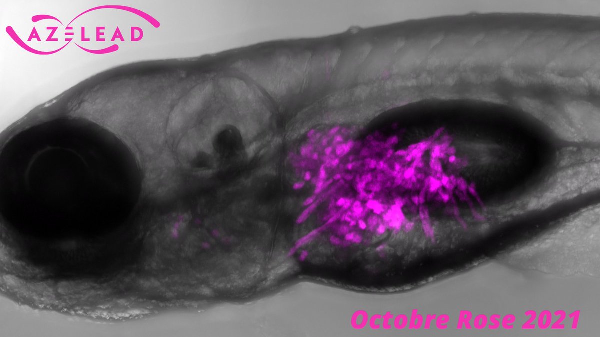 Azelead_Biotech's tweet photo. It's #OctobreRose2021 🌺Cancer Awareness Month🌺

The key work is #prevention. The screenings are fundamental to discover cancer at early stages. In #Azelead, we have a team of women studying the complex mechanisms of #cancer progression.

#CancerAwarenessmonth #Zebrafish https://t.co/NqUDkqZatr