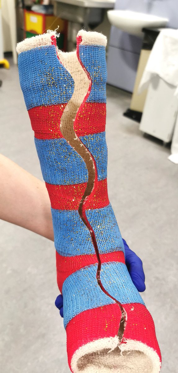 lucyerobson's tweet photo. May well be up there with my top achievements of this rotation?

One striped glittery cast requested, one striped glittery cast made!

#PaediatricPhysiotherapy #MSKPaedsPhysio #ChildrensPhysio #Physiotherapy #MSKPhysio https://t.co/mGlaiej8GL