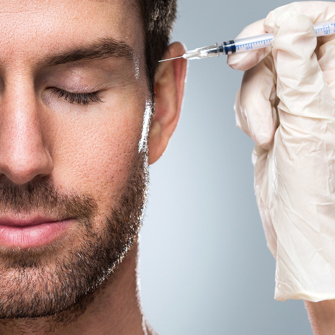 How to Avoid, Recognise, and Treat Complications from Periocular Filler Injections bit.ly/3pn6lZL
#FrancescoBernardini #MorrisHartestein #oculaplastic #periocular #periorbital #injections #postinjections #complications 
#primejournal #aesthetic #antiageing #peerreview