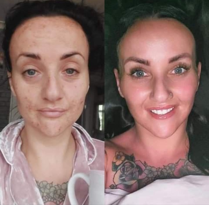 Face to Face Friday 😍
Look at her glow 🌟
DM me to discuss your skin needs 📩