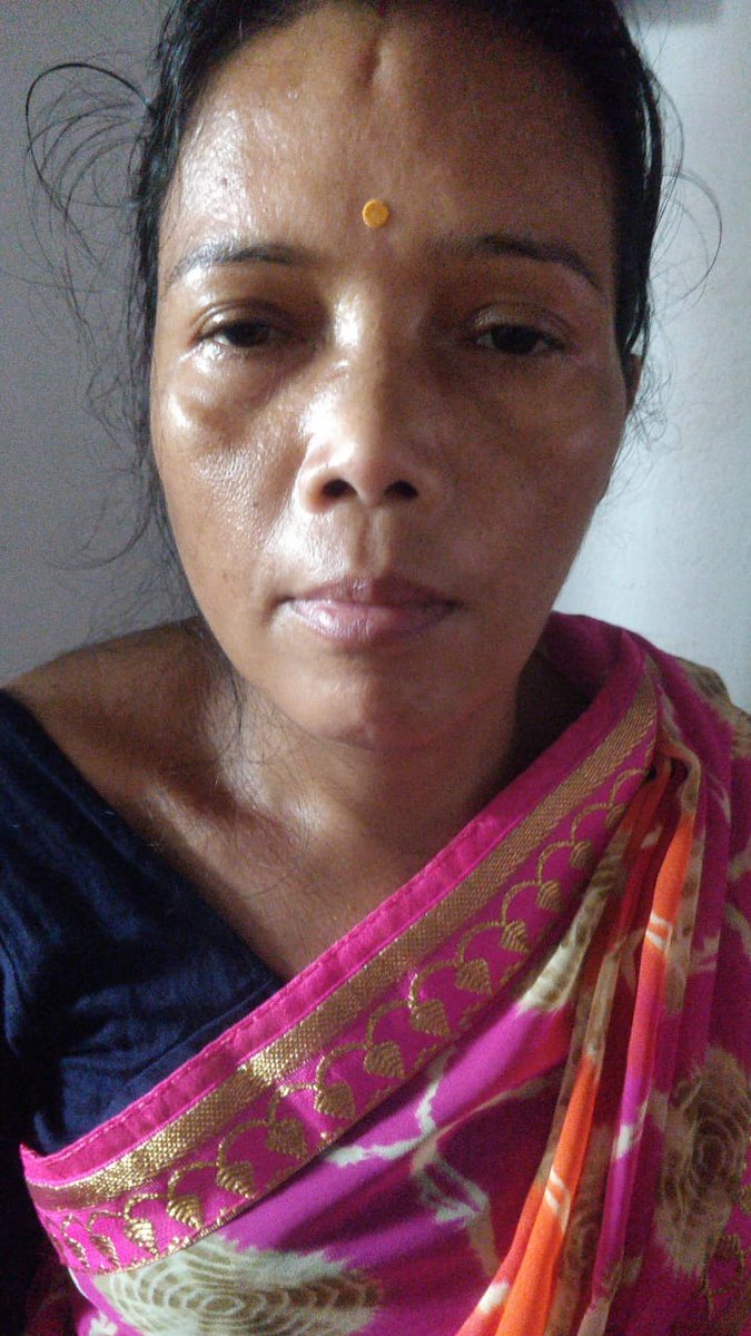 m_solipsistic's tweet photo. https://t.co/SMBTcq4asx
@SonuSood  @SoodFoundation @blogspotme @ketto 

We need some financial help
My friend's mother is critically ill and need to get operated asap
Doctor have told a budget of 15lakh
Any help would be great https://t.co/hH3NlChr2M