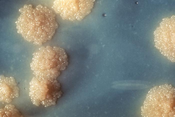 TheLabDoc's tweet photo. "Cauliflower" colonies of Mycobacterium tuberculosis in culture. #PathTwitter #MicroRounds #MicroMed #IDTwitter #MedStudentTwitter https://t.co/i2gWEiIDai