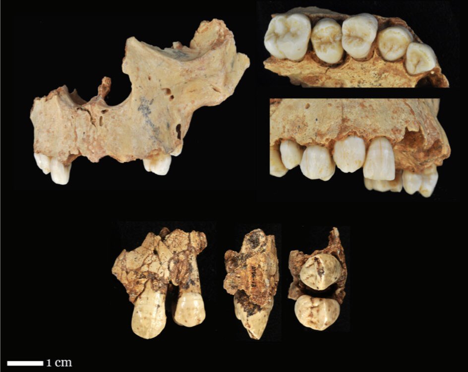 Dimorfismo sexual entre los caninos permanentes de dos individuos de Homo antecessor. A través de técnicas microtomográficas se determinó que los valores obtenidos en el canino ATD6-69 (H3) eran menores al canino ATD6-13 (H1).

isita-org.com/jass/Contents/…