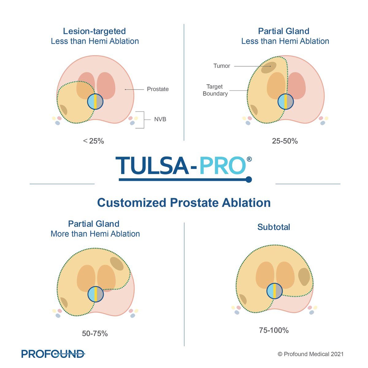 ProfoundMedical's tweet photo. The #TULSAPRO system provides customized treatment plans for patient-specific prostate disease characteristics. Click here https://t.co/O8z2VzQuBc to read the results from a resent single center retrospective analysis.
#urology #radiology #ablatetheprostate #liveaprofoundlife https://t.co/oGgkRYmEhH