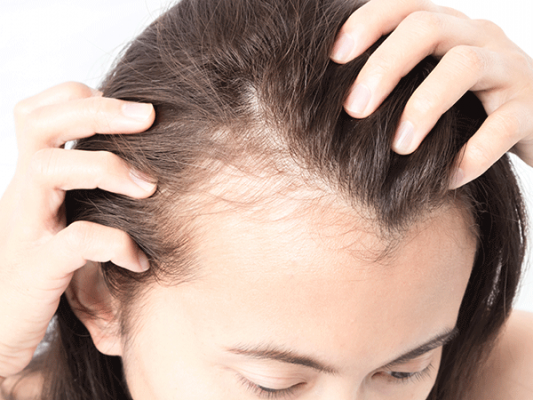 redacteur3's tweet photo. Say goodbye to hair loss and baldness - here's how to grow hair or have hair longer, stronger, fuller and less time - naturally https://t.co/fIaFP74gzq