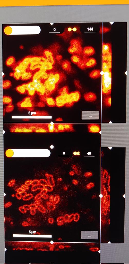 Holy donuts! Awesome 3D-STED z-res (bottom right, confocal image above) using the new deformable mirror on our <a href="/Abberior/">Abberior</a> Facility Line system. See the membranes on tiny Orientia bacteria with <a href="/JSalje/">Jeanne Salje</a>. Big thanks to the Mighty and Meticulous Matthias Reuss for his software genius!
