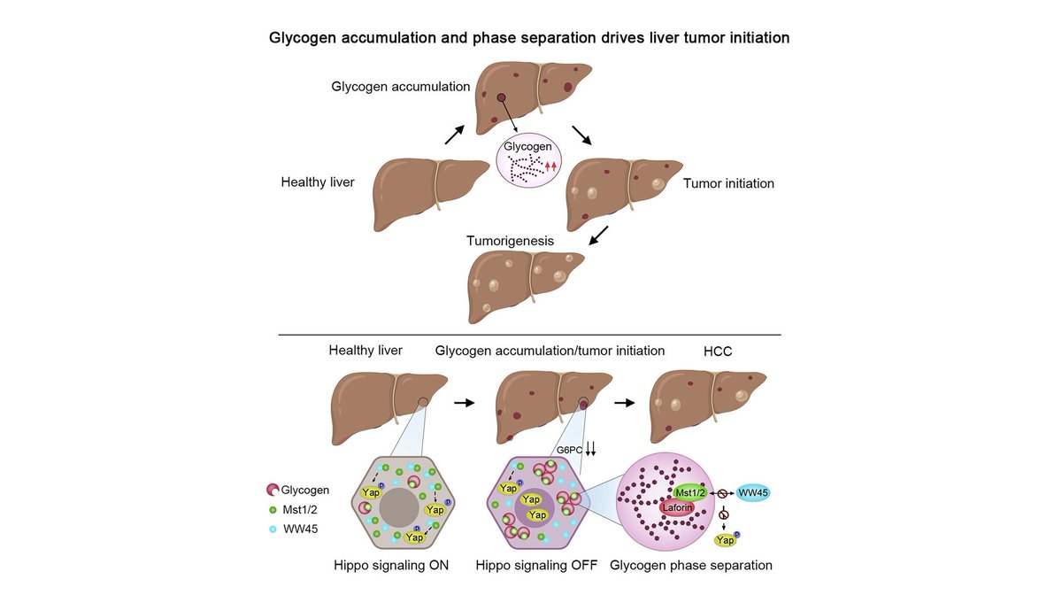 hepaticcellnews's tweet photo. π in @CellCellPress!
A group of Xiamen University researchers report that glycogen accumulation is a key π initiating oncogenic event during liver #MalignantTransformation.
Read more: https://t.co/qnLXNPhh3Z https://t.co/vVL3FX4nGQ