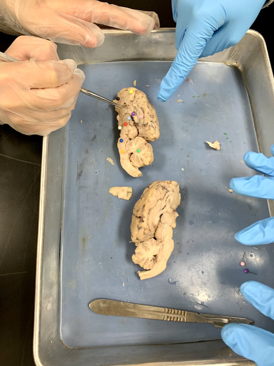 LHSPsychology's tweet photo. To quote a student in 6th period, “today was a bucket list day”! Thank you Dr. Kreutz and Mrs. Owens for lending your classroom to all psychology students as they performed sheep brain surgery 🧠✨ https://t.co/wCoIXideHy