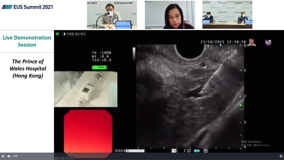 HenryHW_Liu's tweet photo. Nice live demo on EUS PPG measurement by @teoh_anthony at @CUHKGI!
#EUSsummit @DongWanSeo1 @WorldEndoOrg
#GITwitter https://t.co/zEK78Ayj1e