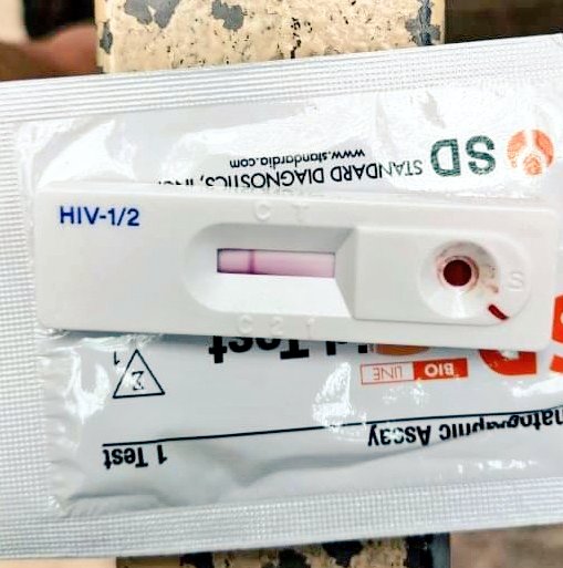 princereyes23's tweet photo. Got tested today! Thank you sa free HIV testing! ๐๐ช #nonreactive #gottested #hivtest #blessed #stayprotected #altermarikina #marikina https://t.co/WweepX3vCT