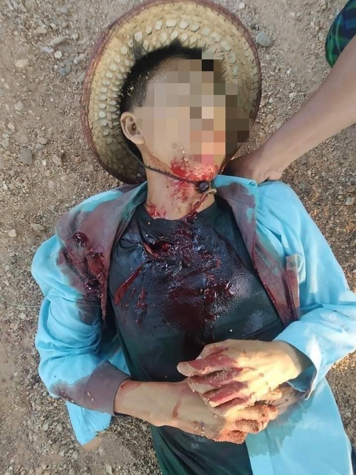 Merries1998's tweet photo. SAC Shot n Killed 3 unarmed locals from KantBaLu n TantSal townships; Military’s uncontrollable atrocities against civilians r accelerating across Myanmar after 9 months of coup. one of them was shot on road even during broad daylight.

#Oct23Coup
#WhatsHappeningInMyanmar https://t.co/SauQ2MVwSs