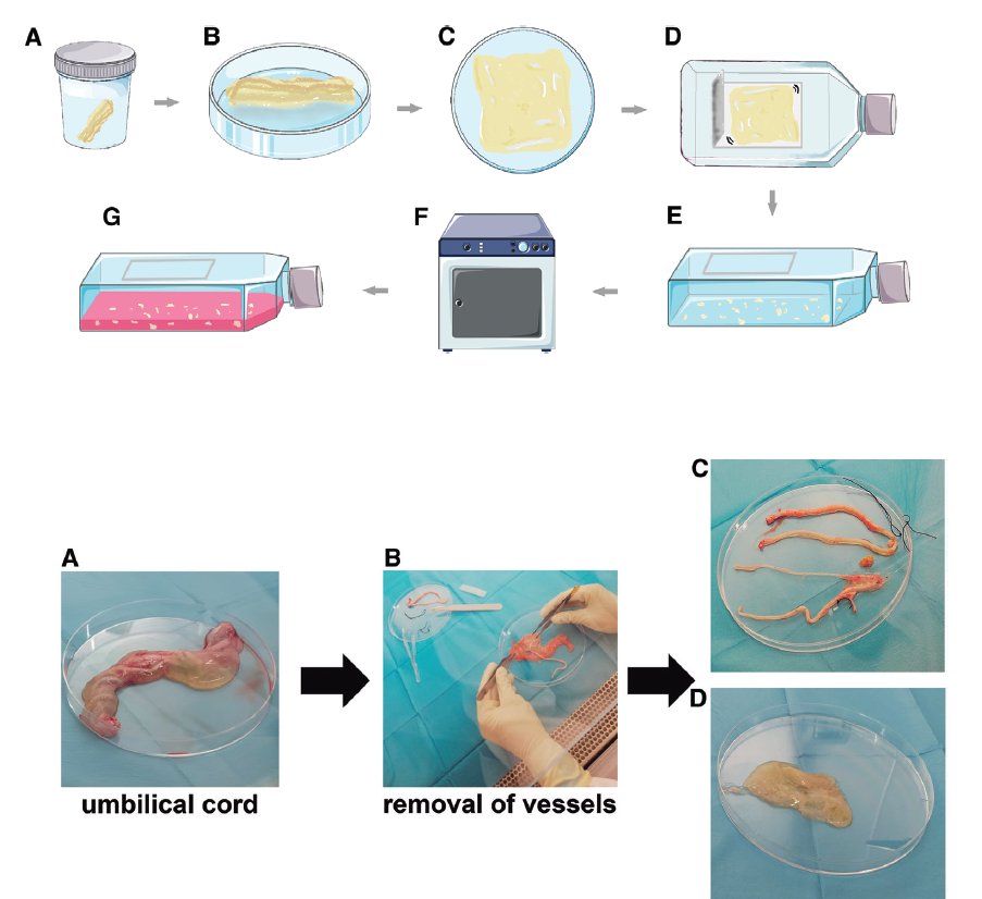 josbaema's tweet image. 💙🧫🧬🔬Isolation and expansion of ovine mesenchymal stromal cells from Wharton’s jelly of the umbilical cord 🧫💙

buff.ly/3E2eLKf

🔬🧬A method found in #labmethods buff.ly/3aTSul5 🧬🔬

#Biofabrication #Cartilage #Bioprinting #MSC  #umbilicalcord #Whartonsjelly