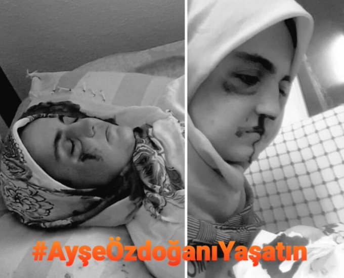 Kanser hastası ve tutsak!!! 
İnsanı yaşat ki Devlet baki kalsın.

#AyşeÖzdoganıYaşatın