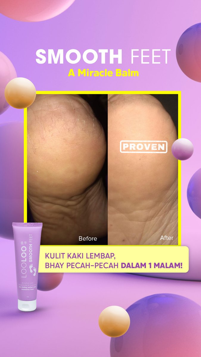 looloo_id's tweet image. Kamu juga bisa punya kaki mulus, gak pecah-pecah dan sehat! 

Link to shop:
shopee.co.id/loolooofficial
_
#looloo #skincare #tipstwitter #shopindie #Shopee1111JackieChan #shopmycloset
