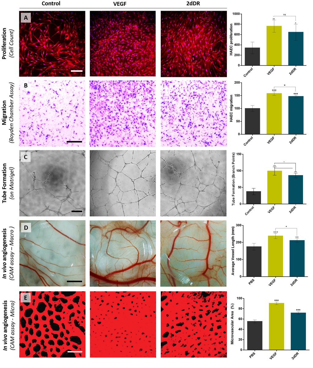 🚨 New article alert: 

Our review paper is now online in <a href="/IJMS_MDPI/">IJMS MDPI</a>. Special thanks to Muhammad Yar @ajbsmirnoff <a href="/microshep/">Joey Shepherd</a> Sabiniano Roman <a href="/SMacneil1/">Sheila MacNeil</a>

Have a look if interested in promoting angiogenesis and healing challenging wounds:

mdpi.com/1422-0067/22/2…