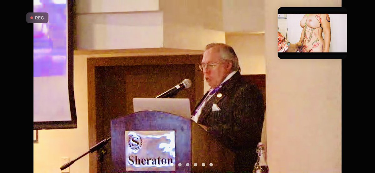 El 𝐃𝐫. 𝗠𝗮𝗿𝗰𝗲𝗹𝗼 𝗔𝗯𝗮𝗱 sobre 𝙴𝚇𝚃𝚁𝙰𝙲𝙲𝙸Ó𝙽 𝙳𝙴 𝙱𝙸𝙾𝙿𝙾𝙻𝙸𝙼𝙴𝚁𝙾𝚂 𝙴 𝙸𝙽𝙹𝙴𝚁𝚃𝙾 𝙶𝚁𝙰𝚂𝙾 𝙰𝚄𝚃𝙾𝙻𝙾𝙶𝙾 𝙵𝚁𝙴𝚂𝙲𝙾 𝚈 𝙲𝙾𝙽𝙶𝙴𝙻𝙰𝙳𝙾 en 𝕀𝕏 𝕁𝕆ℝℕ𝔸𝔻𝔸𝕊 𝕀ℕ𝕋𝔼ℝℕ𝔸ℂ𝕀𝕆ℕ𝔸𝕃𝔼𝕊 𝔻𝔼 ℂ𝕀ℝ𝕌𝔾Í𝔸 ℙ𝕃Á𝕊𝕋𝕀ℂ𝔸 #Guayaquil