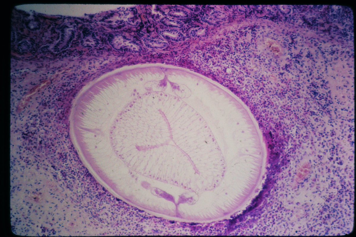 1/ (Thread)
Another spectacular image from the #yalerosenslidecollection courtesy of <a href="/yro854/">Yale Rosen</a> 

This was found in the stomach. What is it? Choices in next tweet 👇🏾