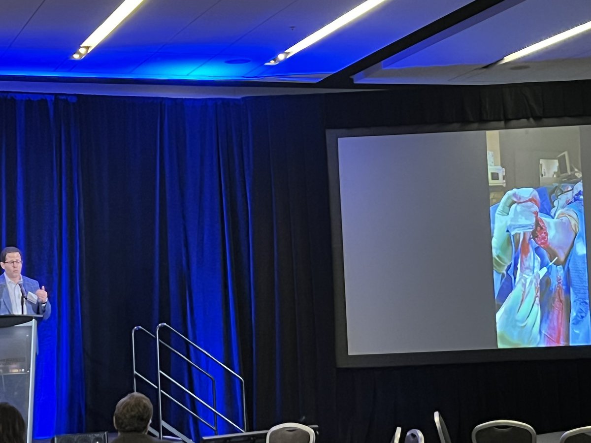 DGArmstrong's tweet photo. How to TMA: @BCM_Surgery Brian Lepow #DFCON21 #ActAgainstAmputation #DiabeticFoot #ALPSlimb https://t.co/v6iq9Vxcry