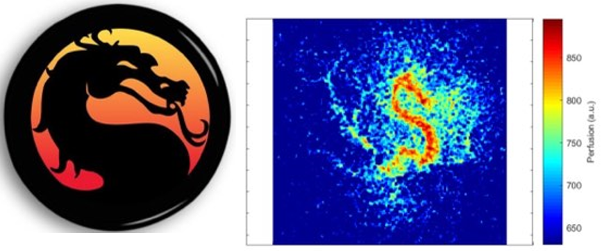 PrasannaPadman7's tweet photo. It was a nice sunny Saturday, so thought of sharing our interesting LSCI perfusion map of chicken vasculature,@JeroenRouwkema's #vascularizationlab,  collaboration with @AtaChizari and @steenbergenw https://t.co/5mWJhoHTm7