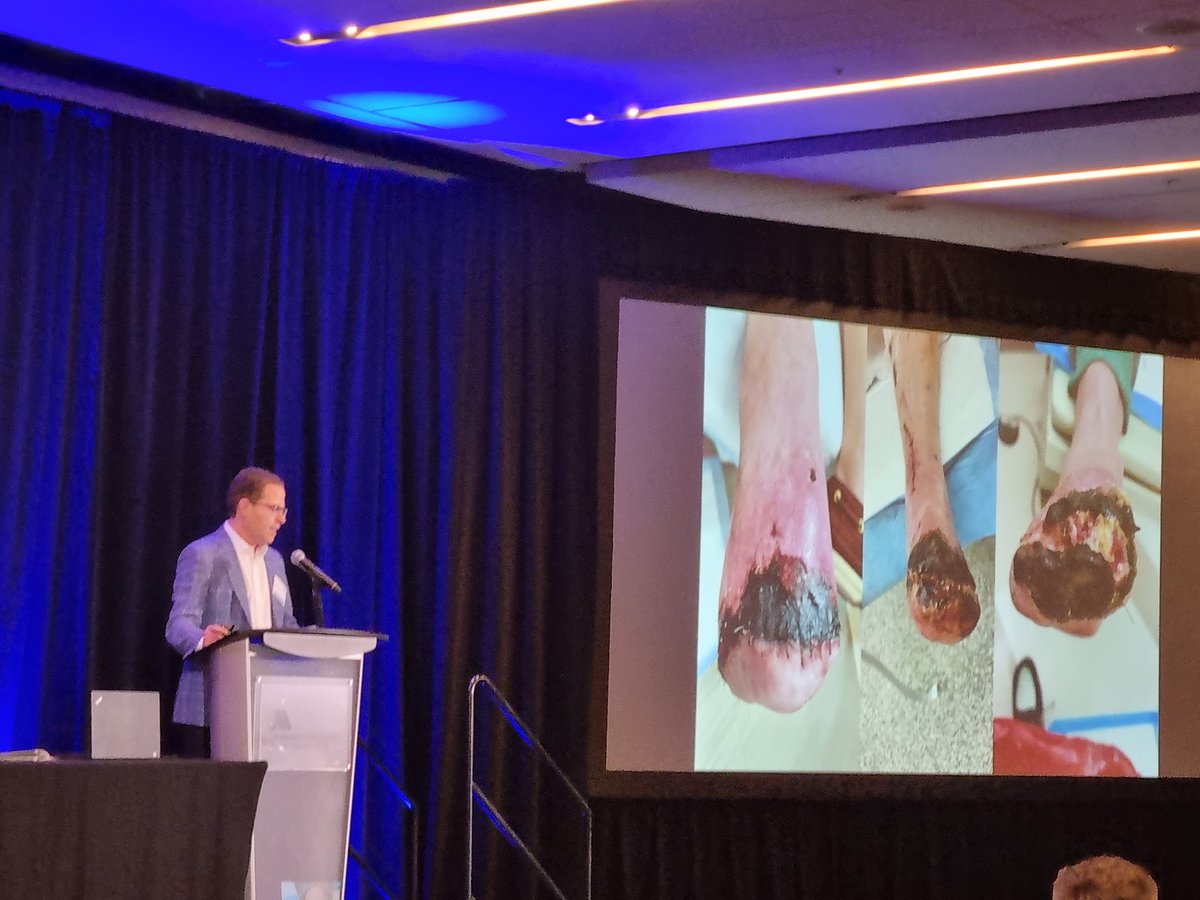QuispeLandeo's tweet photo. Conferencia Mundial Pie Diabético
#DfCon21
#ActAgainstAmputation https://t.co/PYWN92jL99