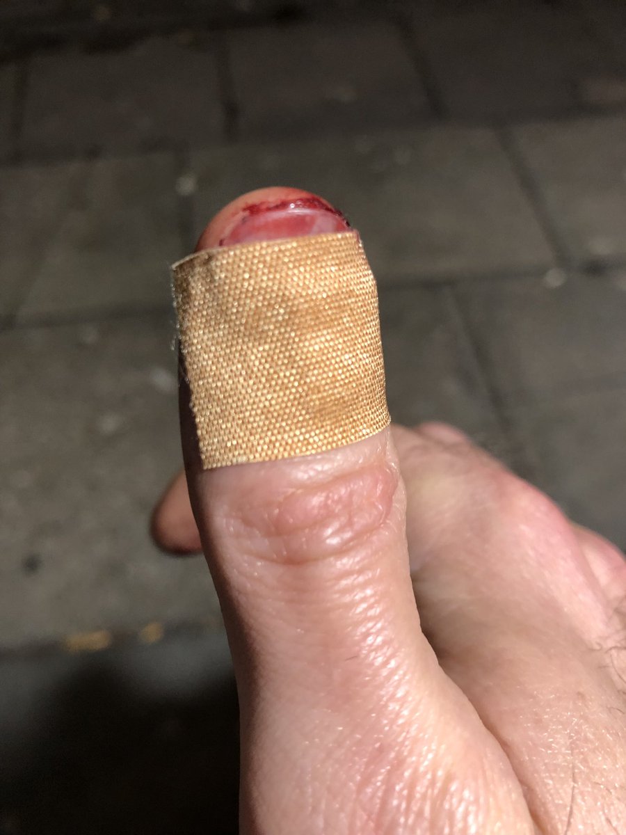 FitLiverpool1's tweet photo. How I ended up Saturday night having pushed by the security guy named John up the stairs at Superstar Boudoir in Liverpool. Have already spoken to police and will be reporting to 101 first thing Sunday morning. Already reported it as hate crime as it is. @SuperstarBoudoi https://t.co/C97ovLaH44