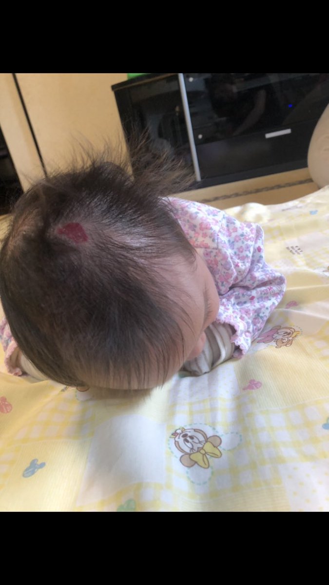 赤アザ Twitter Search Twitter