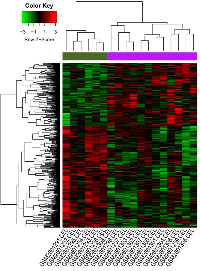 RCMjournal's tweet photo. #RCM - Original Research
Abnormal expression of #TGFBR2, #EGF, #LRP10, and #IQGAP1 is involved in the #pathogenesis of #CoronaryArteryDisease
https://t.co/imuyPsxVxP
#Cardiology #Bioinformatics https://t.co/K2QtuB4rHm