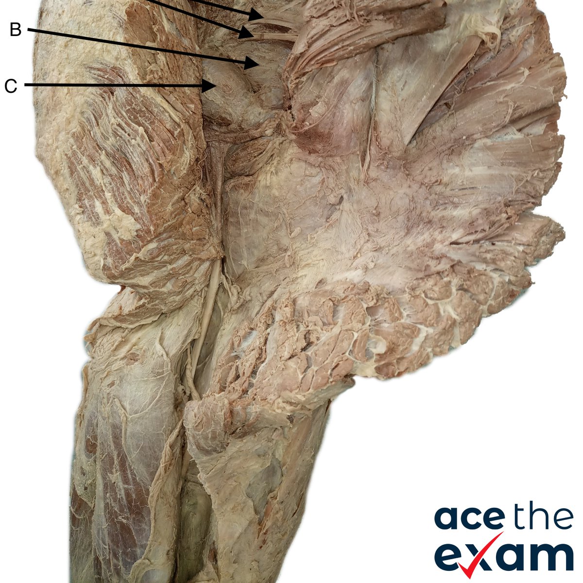 AceTheExam's tweet photo. Want more anatomy spotter practice? Hundreds more high quality images with GSSE-specific questions online at https://t.co/umgw4phT8v Head over to check it out! #GSSE #surgicalexams #RACS #SET #surgicaleducationandtraining https://t.co/QtxCpUKV1G