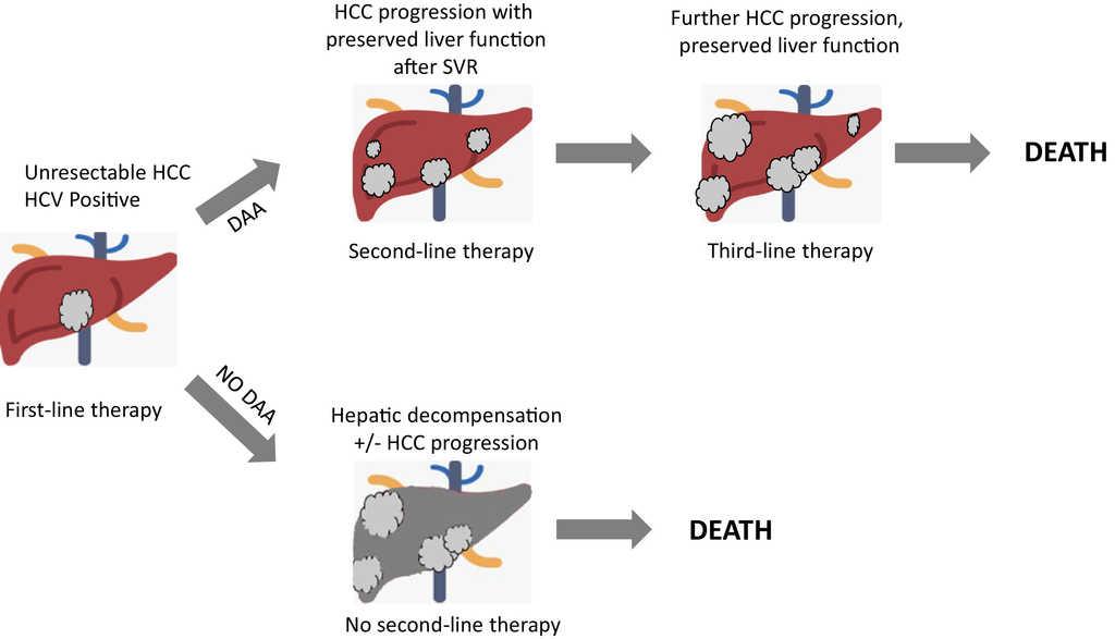 AnnalsofHepatol's tweet photo. Direct-acting antiviral agents and risk of Hepatocellular carcinoma: critical appraisal of the evidence https://t.co/HLmBYN04eQ https://t.co/2Djoup104w