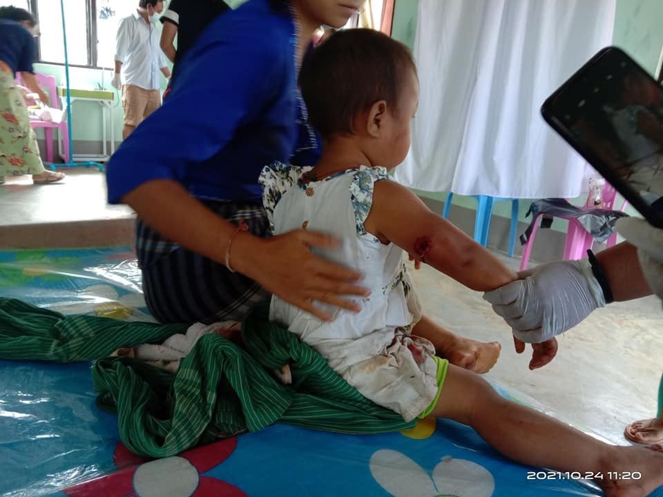 shafiur's tweet photo. #Oct24Coup Mobye Township

SAC ARTILLERY SHELLS INJURE 5 INC YOUNG CHILDREN 

Early am: 5 people including two children,  1 &amp; 4,  were seriously injured due to exploding artillery shells Mobye Township, bordering Shan State &amp; Kayah State. Khit Thit. #WhatsHappeningInMyanmar https://t.co/iT5NUpc5ud
