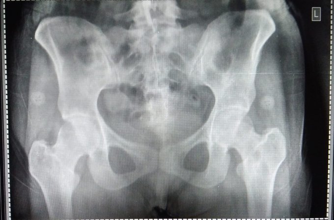 a see through picture of me ;) 💋 https://t.co/wPH8AU5hnp<a href="/tag/newprofilepic"class="tags"><span>#newprofilepic</span></a>