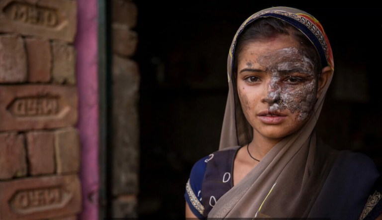 Check out our series of stories on acid attack survivours of North India- thestoriesofchange.com/tag/acid-attac…