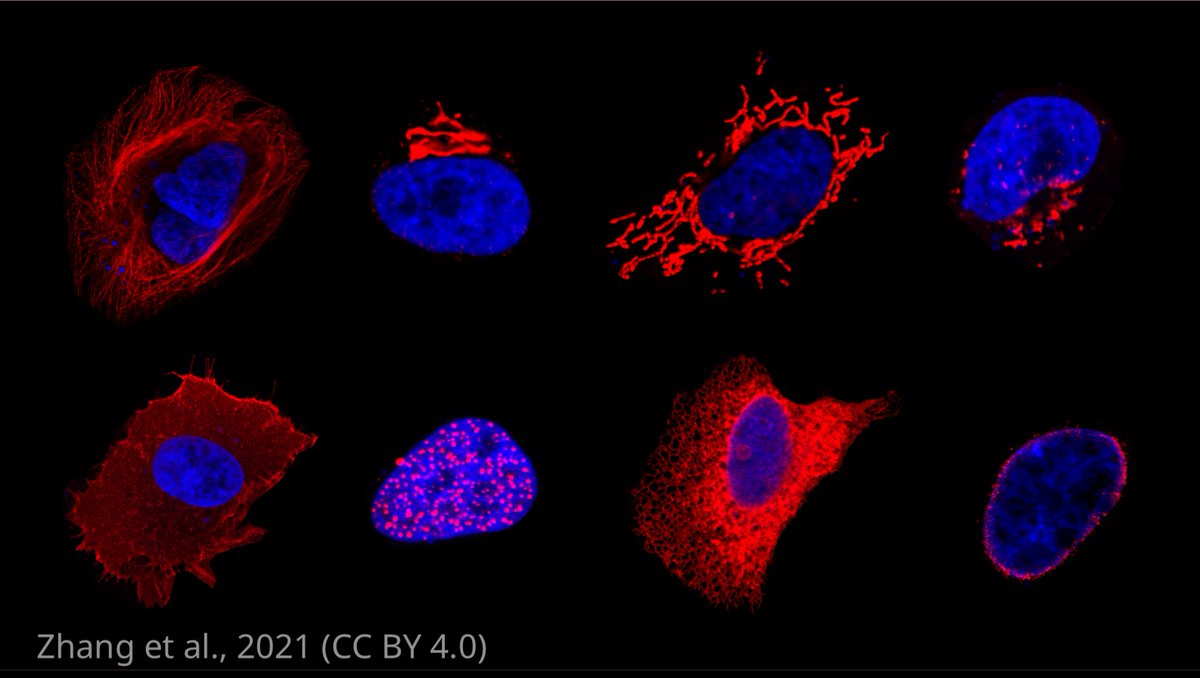 eLife's tweet photo. Researchers have made an immunofluorescence image map of 456 human kinase proteins representing 85% of the human kinome https://t.co/LuI2qRdXpA https://t.co/KpF8Pkvlkh