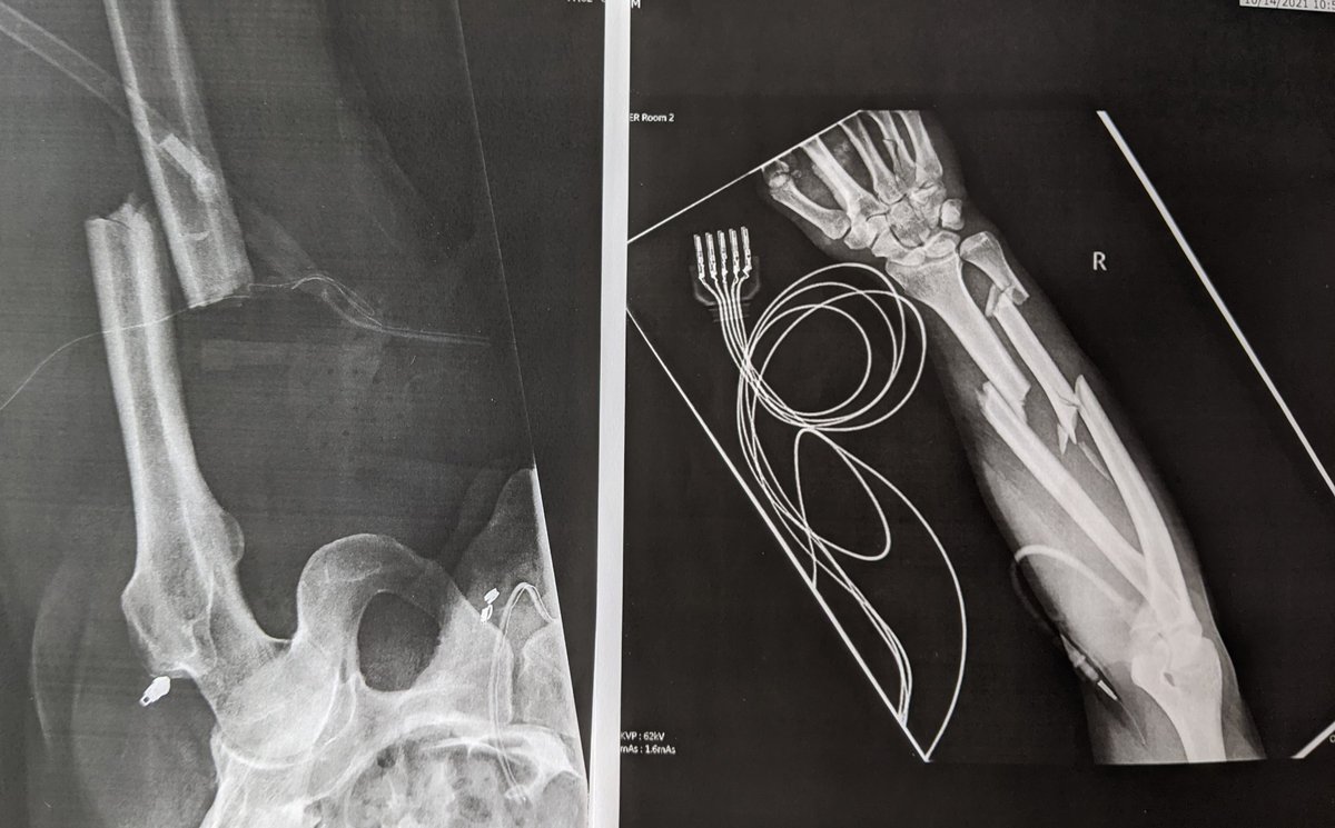 Anurag Agrawal tweet media