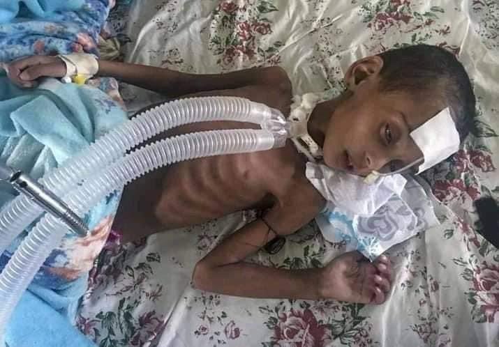 KassaHMariam's tweet photo. Thousands of Tigrayan children &amp; mothers are dying under siege due to man made famine @SenatorMenendez @JosepBorrellF @RepGregoryMeeks @SecBlinken @PowerUSAID @USAmbUN @jakejsullivan @antonioguterres @POTUS @SenateDems @SenateGOP @SenateFloor @wolfblitzer @nimaelbagir https://t.co/56hf9GEf2K