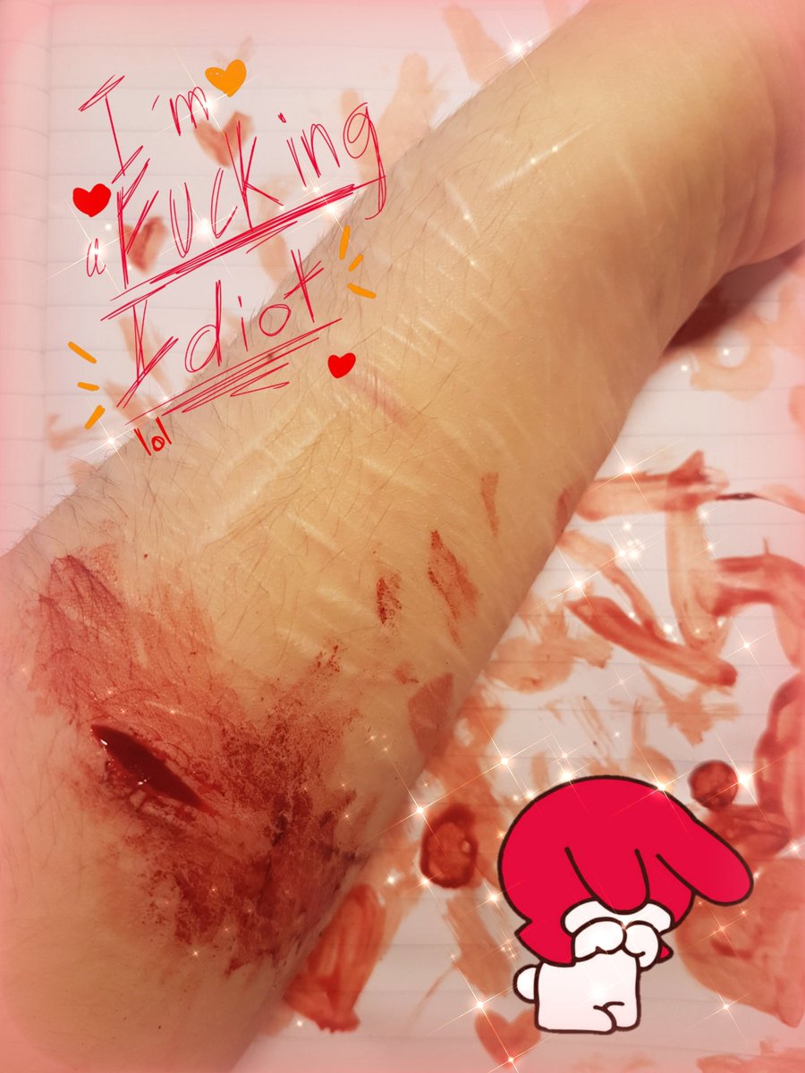 elfenstich's tweet photo. relapsed (◞‸◟；) I only had this really old and dull sharpener blade at hand so I only did a few cat scratches and a small styro ㅠㅠ at least that means less aftercare ? gotta stay positive I guess..

tags: shtwt styrotwt ouchietwt barcodetwt sliceytwt https://t.co/hPnA6mzwYy