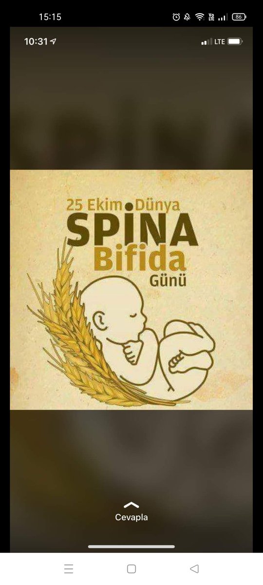 MerveDedeolu7's tweet photo. Spina bifida, anne karnında oluşan bir hastalıktır. Hamileliğin ilk ayında oluşan bu anomalide, bebeğin omurgası şekillenirken tam olarak kapanmaz ve bu nedenle halk arasında “Ayrık omurga hastalığı” olarak da bilinir. Türkiye'de her bin bebekten 3'ünde görülür #25ekimspinabifida https://t.co/OhjxiSCtVz