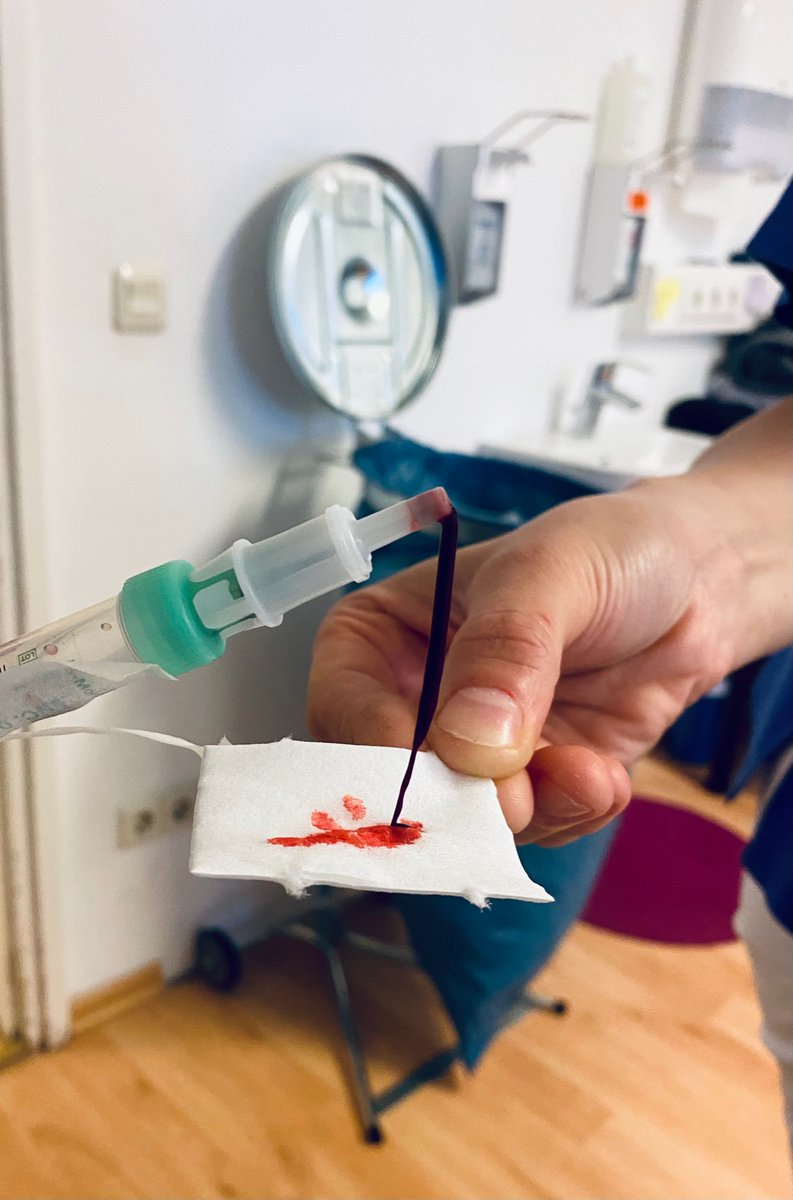 doctorasadkhan's tweet photo. It may interest you to see pictures of my clots &amp; fibrin. Usual clotting tests were normal #MedTwitter #MedEd. https://t.co/n0EPrUpU2t